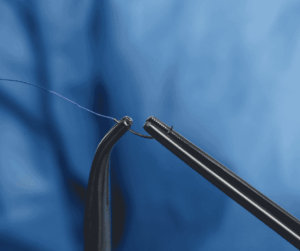 surgeon holding suture thread, classification surgical sutures Colombia
