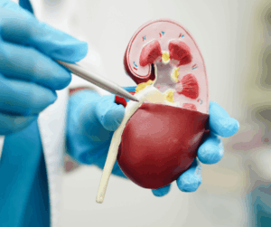 hand pointing to an anatomical kidney model, classification urology devices costa rica