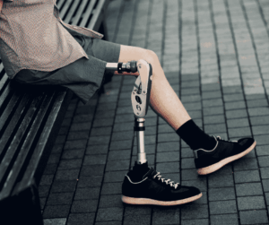 patient with his prosthetic leg, myoelectric prostheses classification Costa Rican