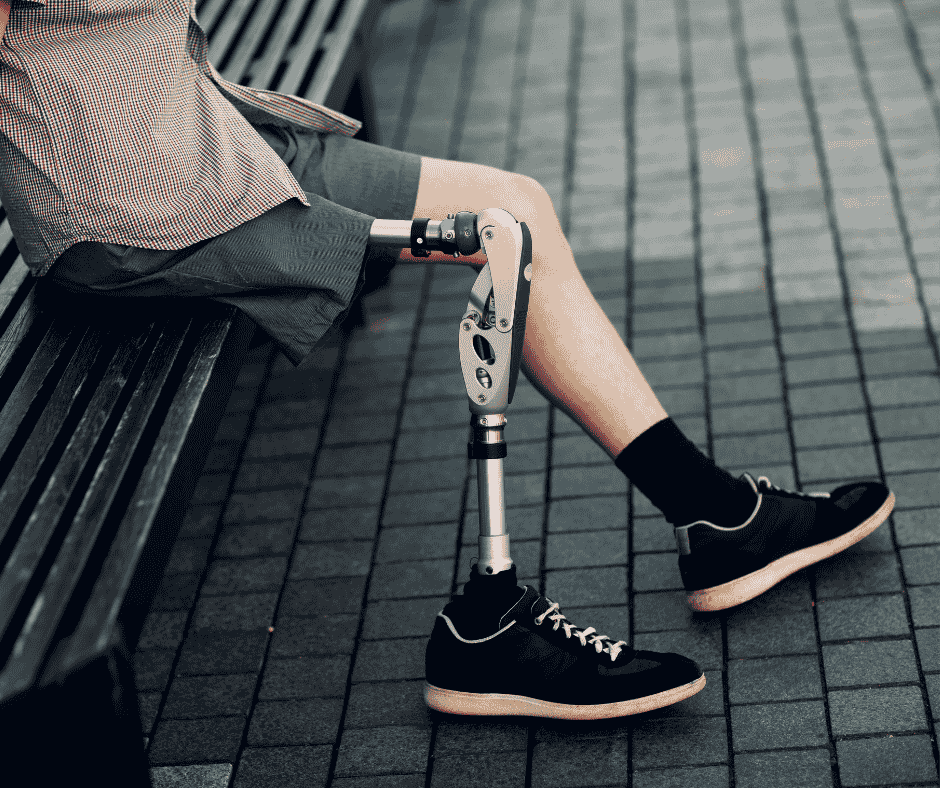 patient with his prosthetic leg, myoelectric prostheses classification Costa Rican
